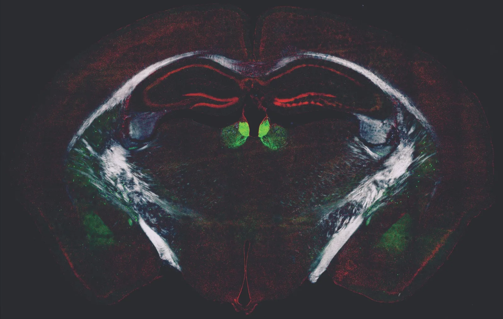 Descubren el mecanismo cerebral que regula cuánto aprendemos diariamente